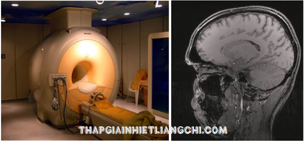 Máy chụp MRI và ảnh chụp