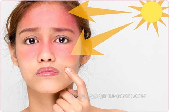 Tia UV có thể làm cháy da nếu tiếp xúc trực tiếp quá lâu