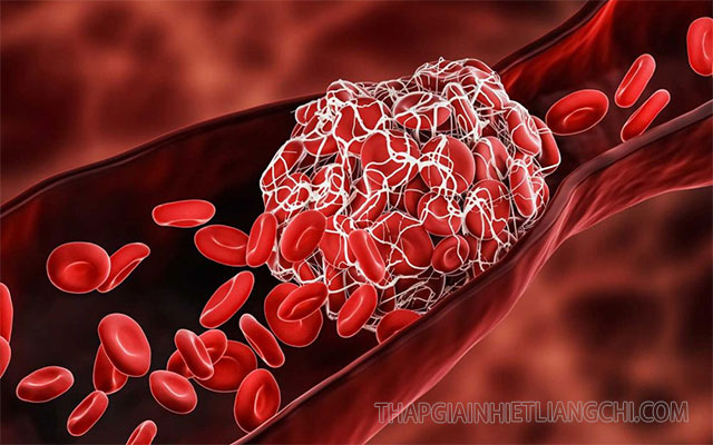 Đông máu là quá trình phức tạp tạo ra các cục máu đông