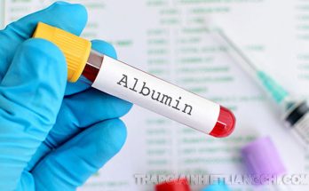 Xét nghiệm albumin giúp chẩn đoán tình trạng sức khỏe của bệnh nhân